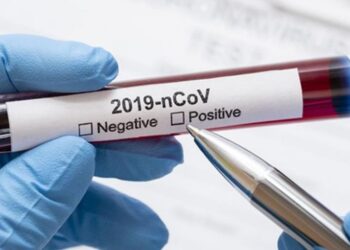 Cada seis minutos se detecta un positivo por Covid en Santa Marta: Salud Distrital