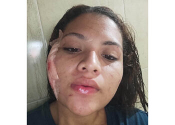 Dos hermanas intentaron asesinar a una mujer, en Gaira