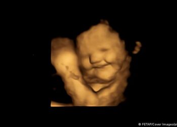 Estudio revela primera evidencia directa de que los bebés reaccionan al gusto y olfato desde el útero