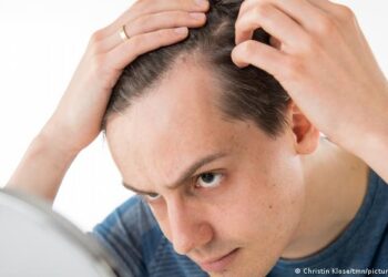 Atención calvos: científicos logran producir folículos de cabello en laboratorio