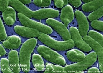 Oleada de infecciones por bacterias «come-carne» afecta a Florida tras el huracán Ian