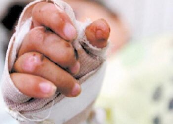 En Magdalena 8 quemados con pólvora en la noche de velitas