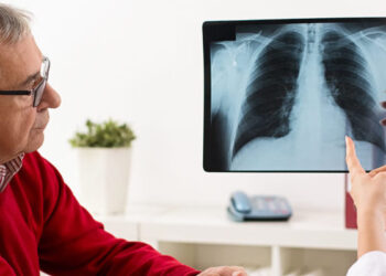 La EPOC en Colombia: un desafío de salud pública que requiere acción inmediata