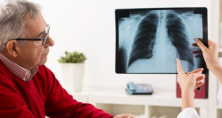 La EPOC en Colombia: un desafío de salud pública que requiere acción inmediata