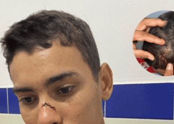 Asalto a vivienda en Plato deja a un joven herido en medio de ola delictiva